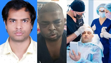 Hair Transplant के लिए Doctor के पास कौन-सी Degree जरूरी, Clinic से लेकर Cost तक, जानें सही जानकारी