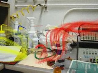 Magnetic fields exposed