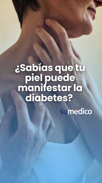 ¿Sabías que tu piel puede manifestar la diabetes?