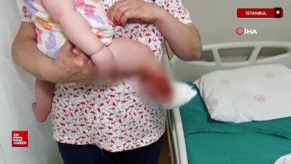 İstanbul’da kaynar su minik Defne’yi yaktı, babaanne kurtardı
