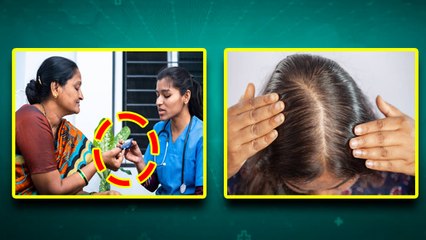 Does Diabetes Cause Hair Loss:डायबिटीज के कारण बाल झड़ते है या नहींं, कैसे रखें ध्यान |