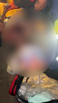 Imágenes fuertes: Andreina fue abusada y atropellada por técnicos de internet