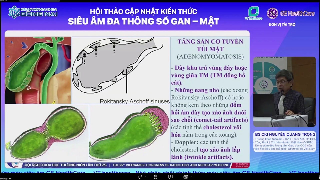 Siêu âm chẩn đoán bướu đường mật - Bs Nguyễn Quang Trọng