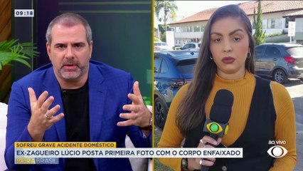 Ex-zageiro Lúcio posta primeira foto com o corpo enfaixado após acidente