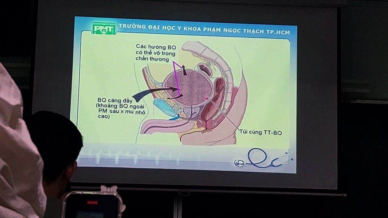 Siêu âm niệu quản, bàng quang, tiền liệt tuyến