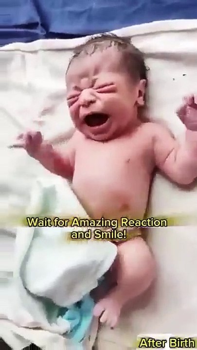 Funny video #bestfunnyvideo #topbestfunnyvideo #vi