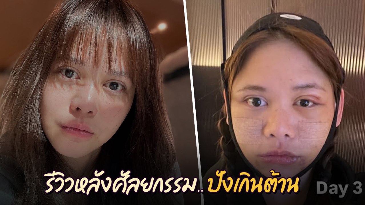 พิมพ์ พิมพ์มาดา หลังศัลยกรรม ในวัย 45 ปี เป๊ะปังเว่อร์