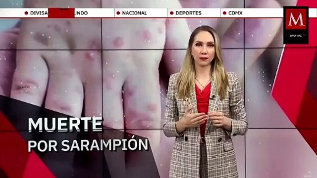 Muere menor sin vacunar por sarampión en Sonora, confirman autoridades