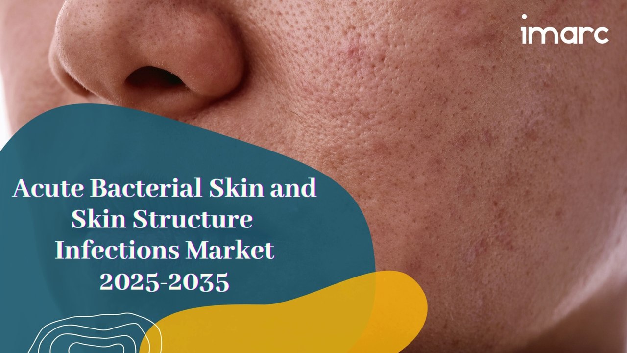 Innovations in Acute Bacterial Skin and Skin Structure Infections Treatment: What’s Trending in the Market?