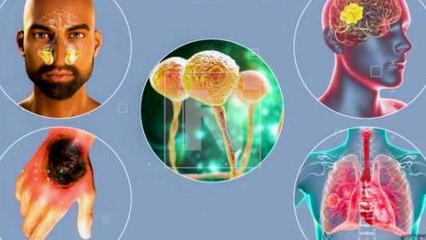 Este es el equipo que venció al Hongo Negro y devolvió la esperanza a Patricia