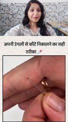 कॉट लगे तो कैसे निकाले #shorts #viral #trending