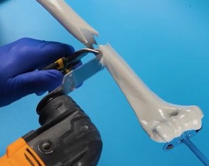 Surgical Secrets! How Popular Medical Procedures Are Performed