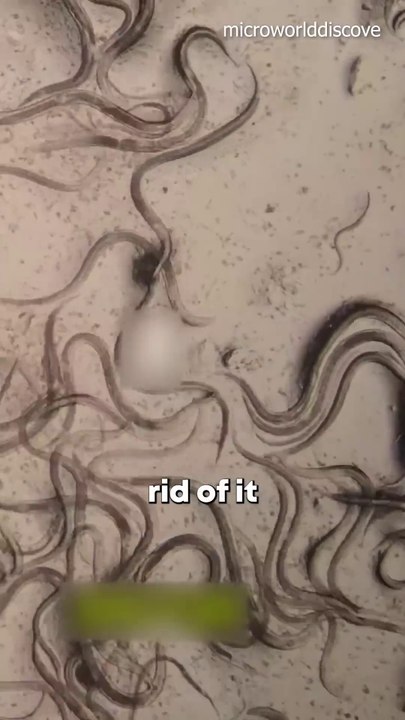 This Tiny Createre is a Parasite