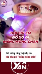 Hội chị em kéo nhau đi niềng móng chân