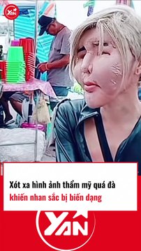 Xót xa hình ảnh thẩm mỹ quá đà khiến nhan sắc bị biến dạng