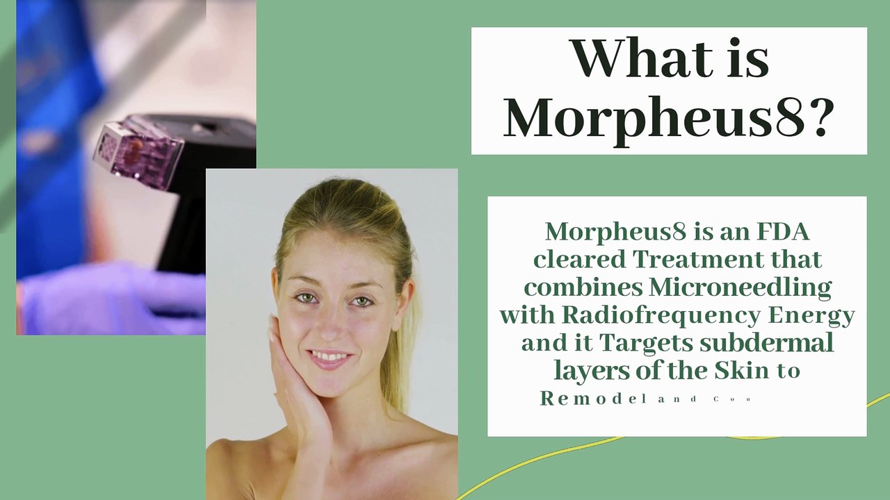 Morpheus8 Near me