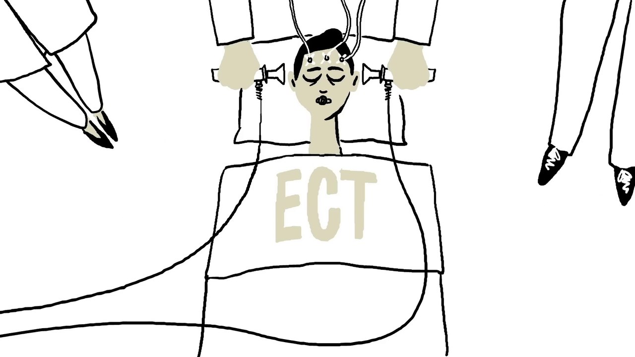 The truth about electroconvulsive therapy (ECT) - Helen M. Farrell