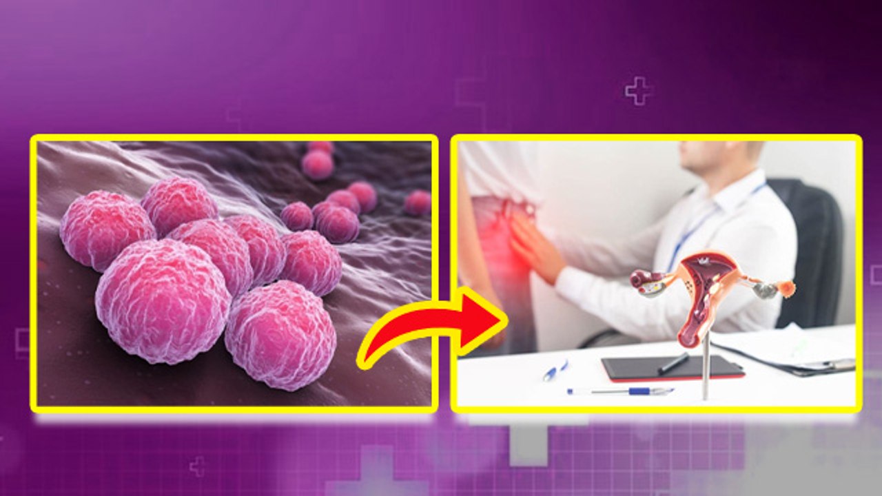 Bartholin Cyst Treatment: बार्थेलिन सिस्ट क्यों होता है,कारण,लक्षण और इलाज | Boldsky