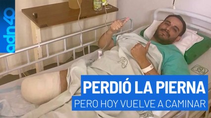 Jorge perdió la pierna por negligencia médica y hoy vuelve a caminar.