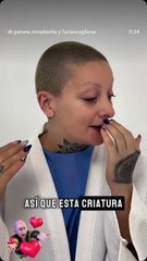 Furia se somete a una cirugía de nariz para mejorar su apariencia ✨