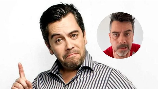 Carlos Espejel sufre parálisis facial y explica en video: Es por estrés