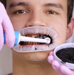 Comment assurer la sécurité et prendre soin de vos dents grâce à ces ASTUCE simples