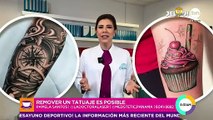 Mi mejor versión: método para remoción de tatuajes