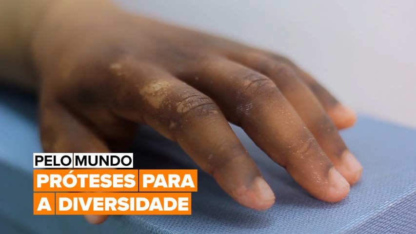Pelo mundo: Próteses para a diversidade