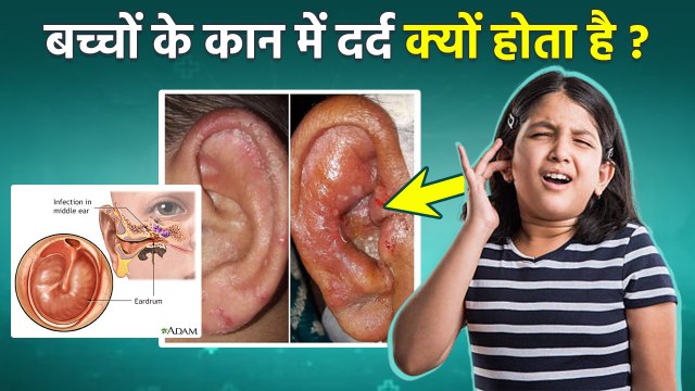 बच्चों के कान में दर्द क्यों होता है, Sudden Ear Pain In Children Causes, Symptoms & Treatment...