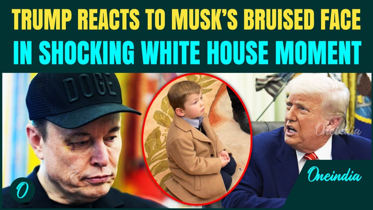 Musk Shows Up to White House With Black Eye -Says Someone Hit Him, Trump Reacts | Conspiracies Erupt