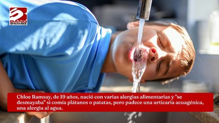 El agua, entre las 40 alergias diferentes de una adolescente