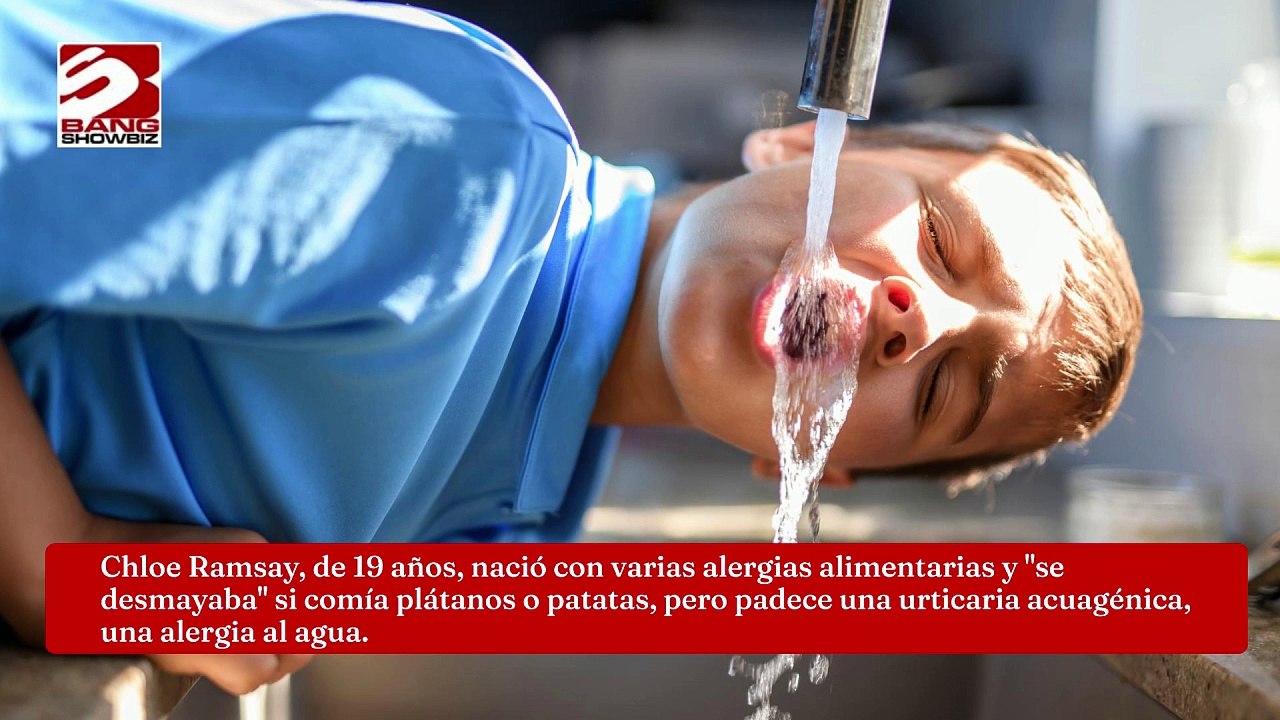 El agua, entre las 40 alergias diferentes de una adolescente