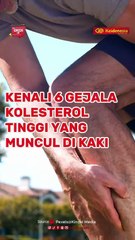 Kenali 6 Gejala Kolesterol Tinggi yang Muncul di Kaki