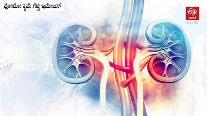 ಒಂದೇ ಕಿಡ್ನಿ ಹೊಂದಿರುವವರು ಸಾಮಾನ್ಯರಂತೆ ಬದುಕಲು ಸಾಧ್ಯವಿದೆಯೇ? ಈ ಬಗ್ಗೆ ತಜ್ಞರು ಏನಂತಾರೆ?