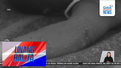 Panayam kay Sec. Ted Herbosa, Department of Health Secretary | Unang Balita