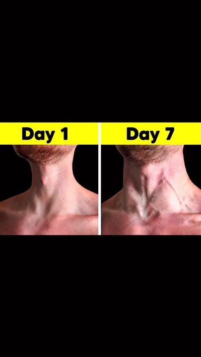 neck exercise