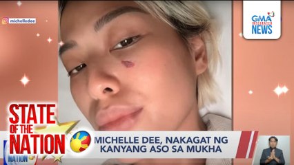 Michelle Dee, nakagat ng kanyang aso sa mukha | SONA