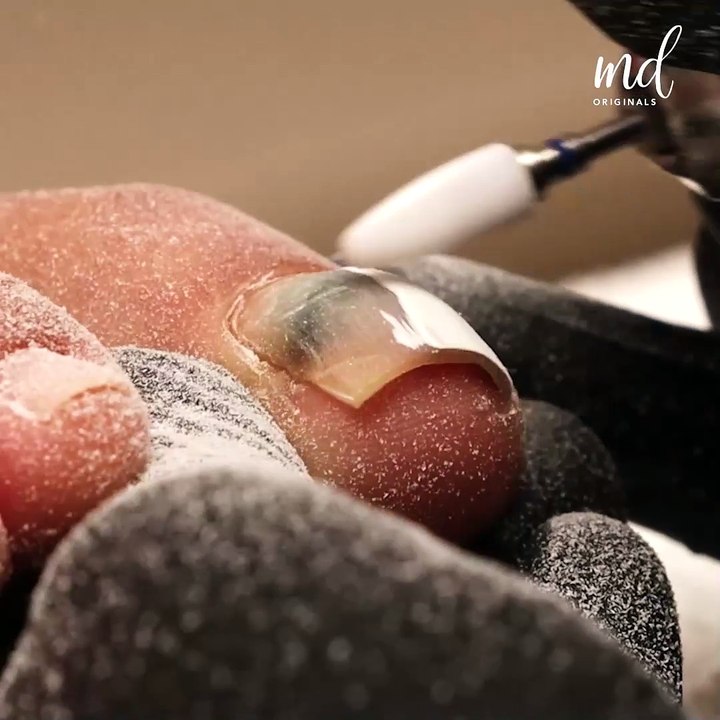 Fixing incredibly damaged nails💅