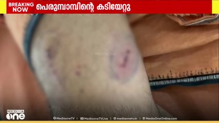 ബാലുശ്ശേരി കണ്ണാടിപ്പൊയിലിൽ രണ്ട് പേർക്ക് പെരുമ്പാമ്പിൻ്റെ കടിയേറ്റു