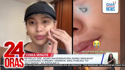 Michelle Dee, agad nagpabakuna nang makagat ng kanyang furbaby: Hinimok ang publiko to "act quick" sa katulad na insidente | 24 Oras