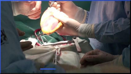 Victorian-age disease is on the rise: How to spot Syphilis