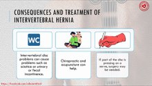 Consequences and treatment of intervertebral hernia