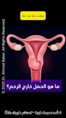 ما هو الحمل خارج الرحم؟ أسبابه وأعراضه وخطورته على صحتك