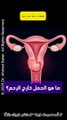 ما هو الحمل خارج الرحم؟ أسبابه وأعراضه وخطورته على صحتك