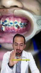 Dile adiós a la asimetría facial