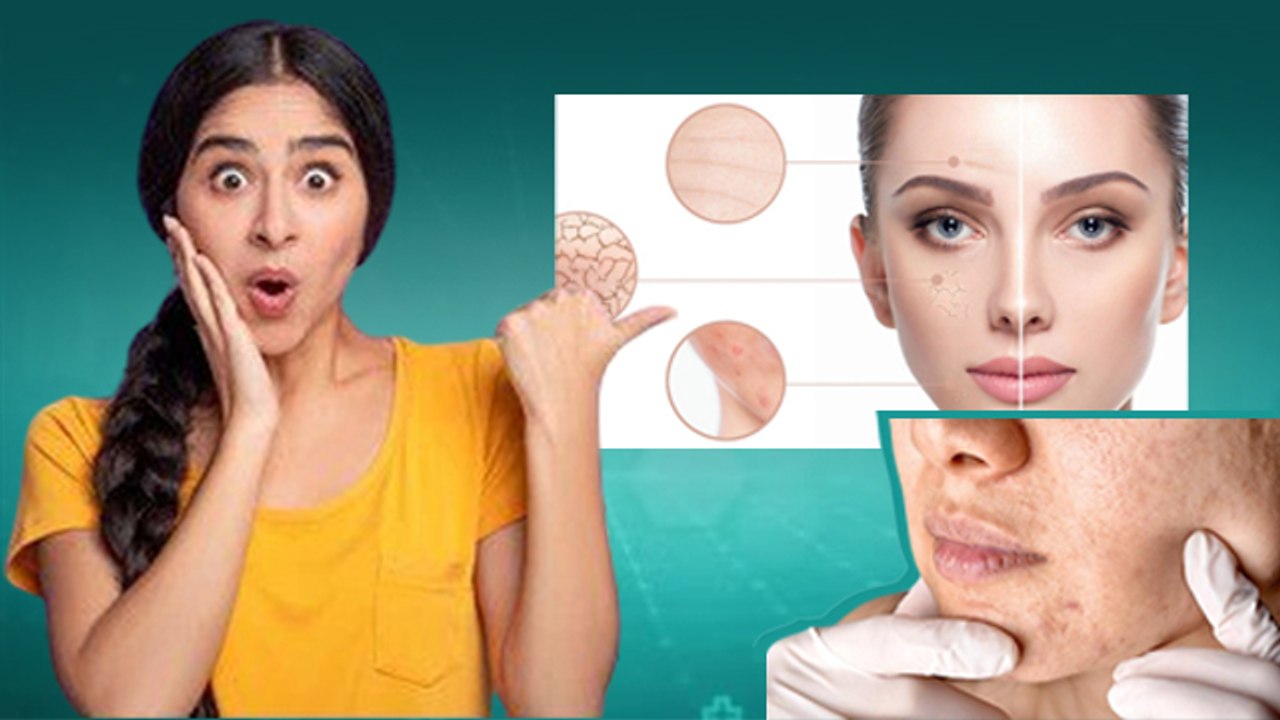 Skin Congestion Treatment: चेहरे के छेद बंद क्यों हो जाते है, Clogged Pores Home Remedy...