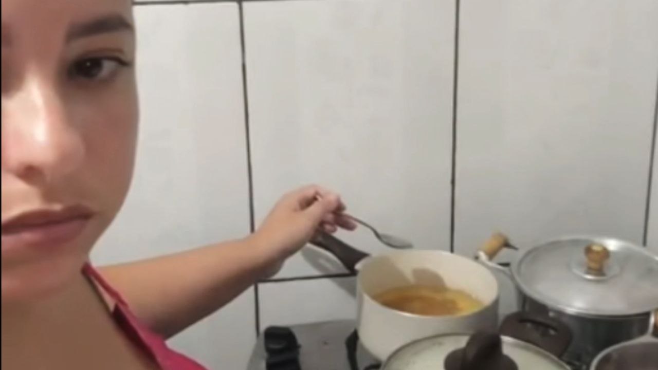 Woman’s chest burned after coxinha unexpectedly exploded