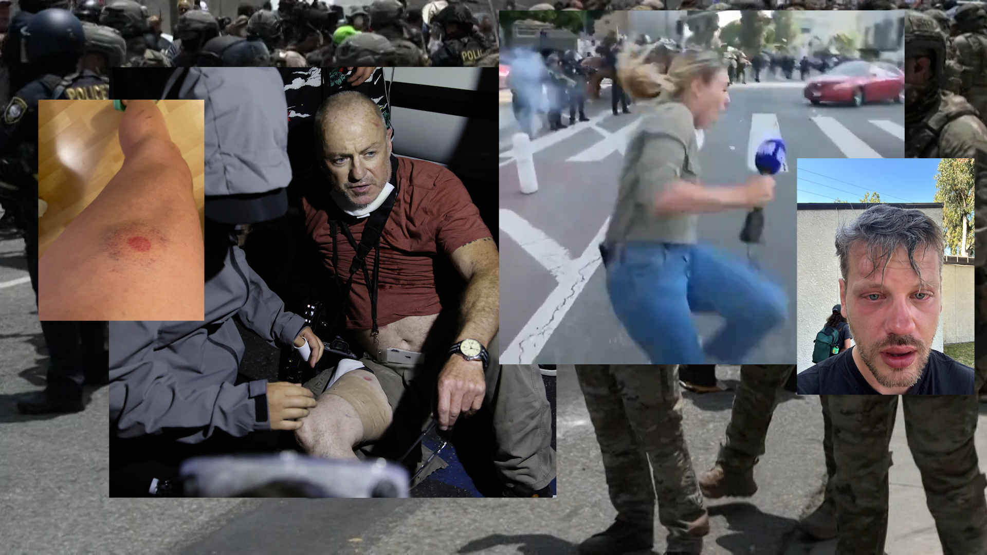 Los Angeles : plusieurs journalistes ciblés et blessés alors qu'ils couvraient les affrontements