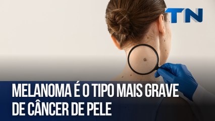 Melanoma é o tipo mais grave de câncer de pele