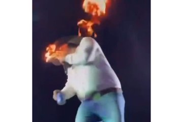 A singer was set on fire when on-stage pyrotechnics malfunctioned
